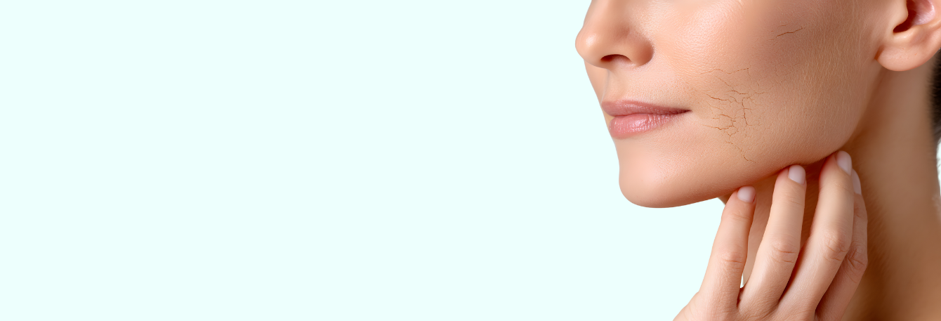 A száraz bőr ápolása