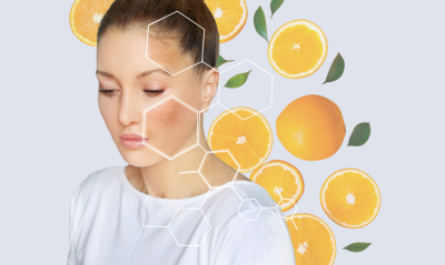 Bőrszépítő vitaminok A-tól Z-ig